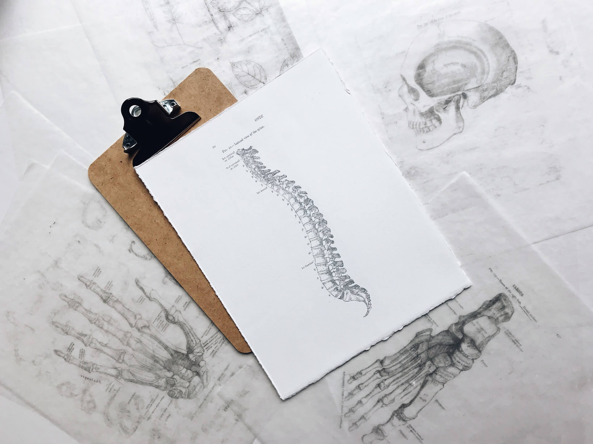 A clipboard with a diagram of a spine.